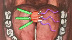 What Really Causes Cavities?: asset-mezzanine-16x9