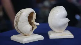 Appraisal: Whale Eardrums, ca. 1935: asset-mezzanine-16x9