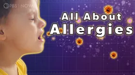 What are Allergies?: asset-mezzanine-16x9