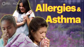 Understanding Allergies, Asthma, and Eczema: asset-mezzanine-16x9