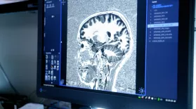 How Does a Brain on THC Compare to a Brain on CBD?: asset-mezzanine-16x9