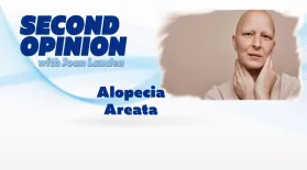 Alopecia Areata: asset-mezzanine-16x9